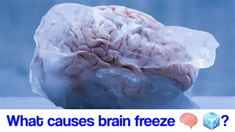 What Causes Brain Freeze 🧠 🧊 Youtube