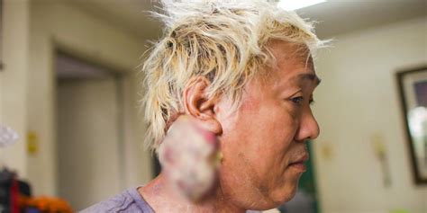 Ate Gay Diagnosed With Stage Cancer Wala Raw Lunas GMA News Online