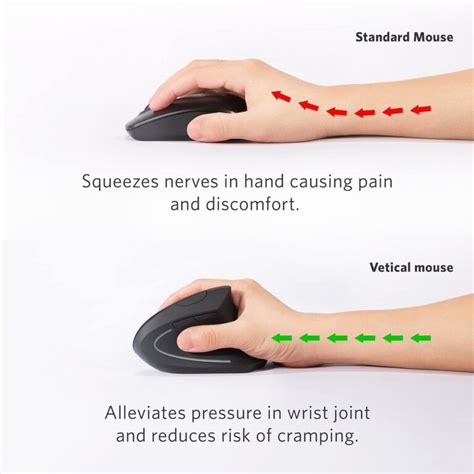 11 Best Ergonomic Mouse For Wrist Pain 2022 Experts Review