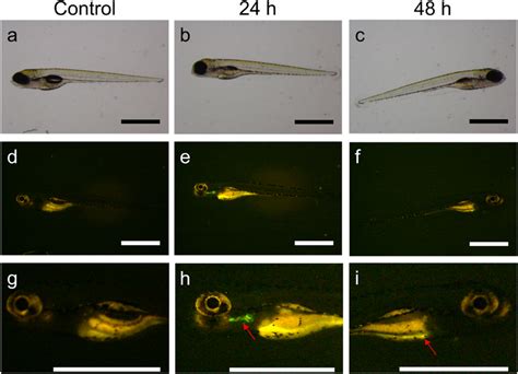 Evolution of MSR uptake in zebrafish larvae. Bright-field optical ...