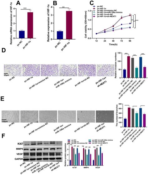 LncRNA NEAT1 Promotes Angiogenesis Of Retinoblastoma Cells Through