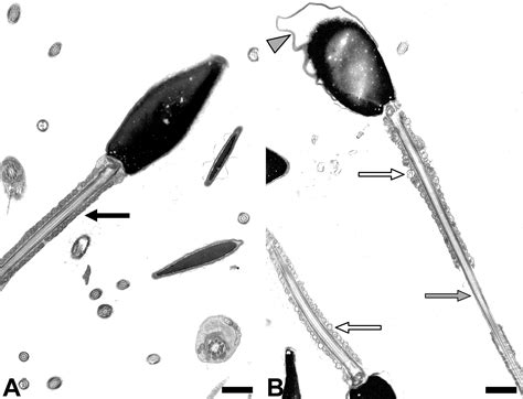 Sperm Electron Microscope