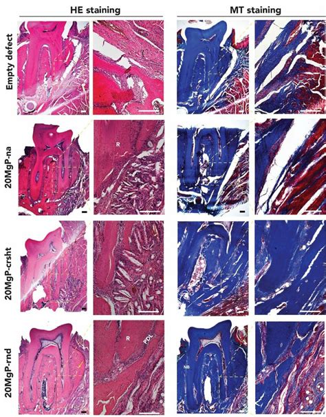 Histological Analyses Of Hematoxylin And Eosin He Staining And