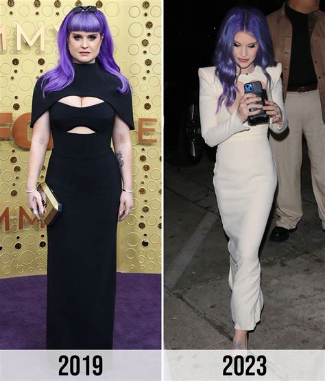 Kelly Osbourne Says She’s ‘Never’ Had Plastic Surgery But Admits To
