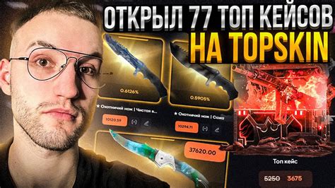 ПРОВЕРКА *ТОП КЕЙСА* на TOPSKIN! *Топ кейс* здорового человека на ...
