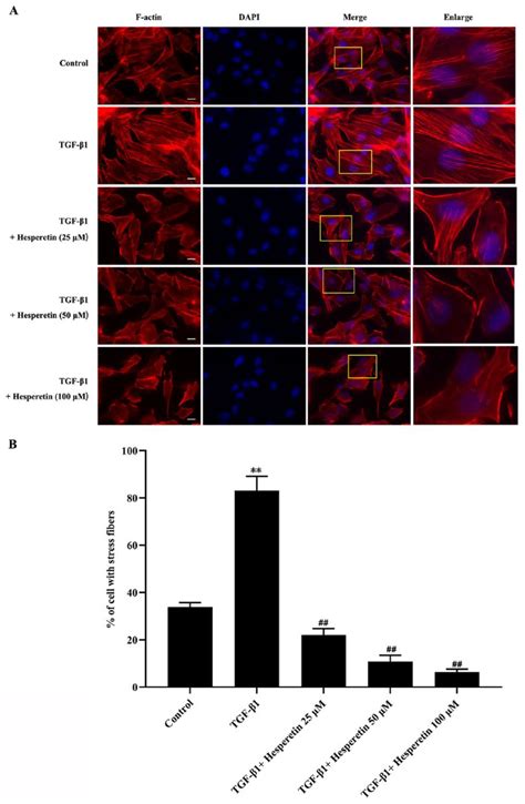 Hesperetin Inhibits Tgf Induced Migration And Invasion Of Triple