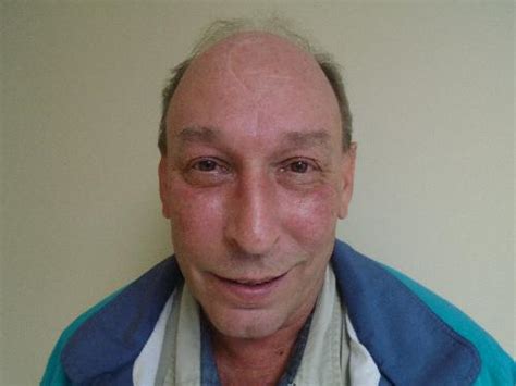 Webb Jr Ronald Norman Sex Offender In Winchendon Ma Maajesfbwwetlzriddvgzlz Tdewdtbu