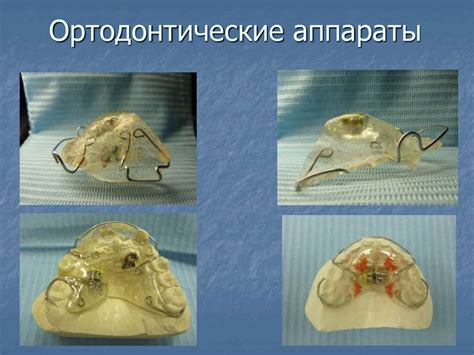 Введение в ортодонтию - презентация онлайн