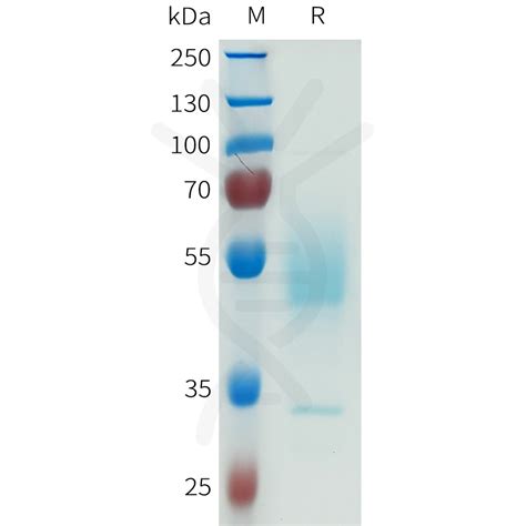 human cdh  protein hfc tag dima biotechnology