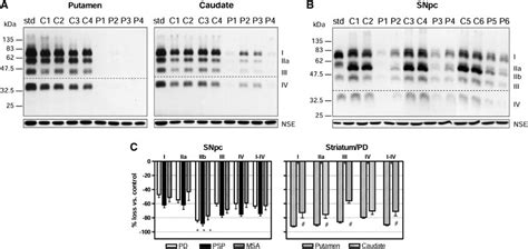 Vesicular Monoamine Transporter Vmat In The Brain Of Patients With