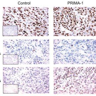 Xenograft Tumors In Nude Mice Derived From PCDNA A And P53 L Five To