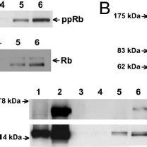 EBNA 6 Binds S18 2 In Vitro A GST S18 2 Precipitates EBNA 6 From