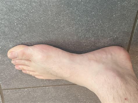 Right foot has painful issues, what’s going on and how can I fix? : r