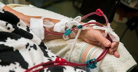 hemodialysis  advanced ckd