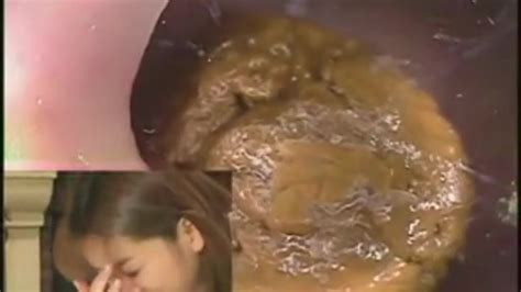 Endoscope Inside Beautyful Ass ThisVid