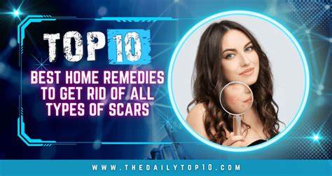 Top 10 Best Home Remedies To Get Rid Of All Types Of Scars