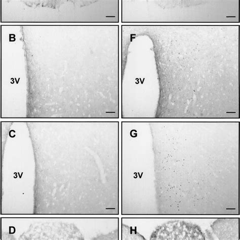 Representative Photomicrographs Illustrating C Fos Immunohistochemistry