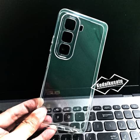 Infinix Hot G Clear Case Hd Softcase Clear Transparent Anti Fungus Infinix Hot G