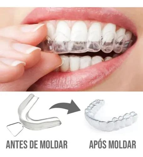 Protetor De Dente Para Dormir - Protetor De Dentes Para Dormir Moldável Bruxismo 04 Placas | MercadoLivre