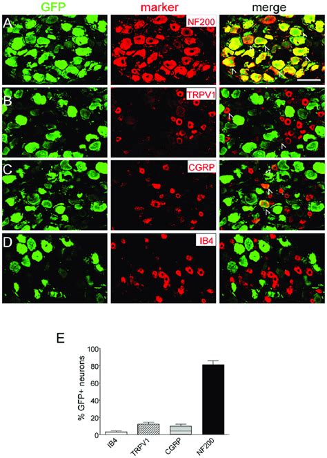 Expression Of Gfp In Different Populations Of Neurons In The Lumbar