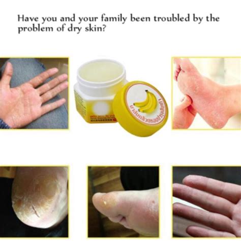 jual obat tumit pecah  kering cream penghalus tumit kaki krim cream