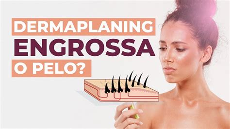 Dermaplaning Engrossa O Pelo - DERMAPLANING ENGROSSA O Pelo Do Rosto? Dobre seu faturamento com essa ...