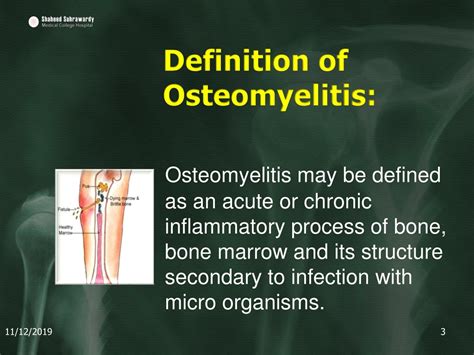 Acute Osteomyelitis Definition at Rose Briggs blog