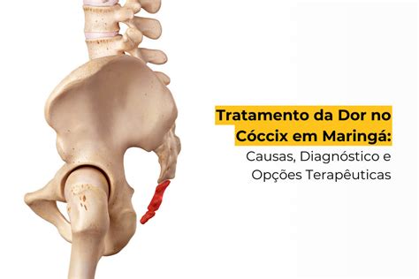 Coccix Inflamado O Que Fazer - Dor No Coccix Humano DOR NO CÓCCIX:O QUE É ? SINTOMAS, TRATAMENTO