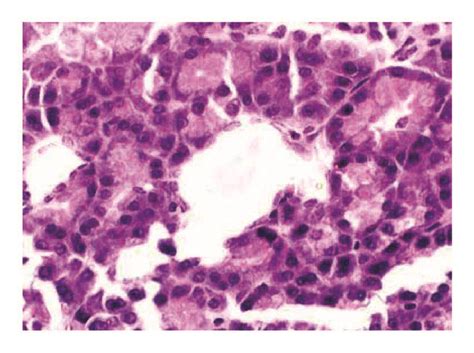 Photomicrographs Of Pancreas Sections In Each Group Normal Pancreatic