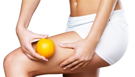 True Or False Myth Busting Facts About Cellulite