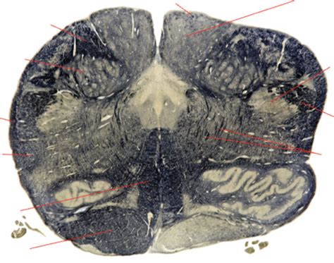 Brainstem Cross Sections Use Flashcards Answer With Term To Study