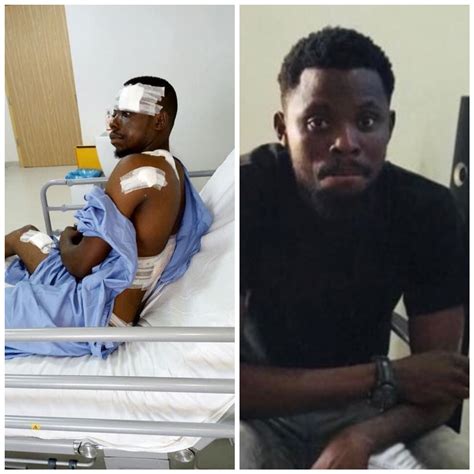 "9 bullets, 3 surgeries. God is the greatest" - Nigerian man marks