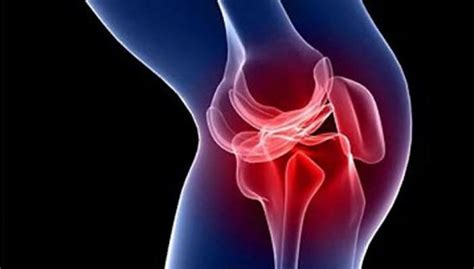 Распространенная травма спортсменов: лечение при растяжении связок ...