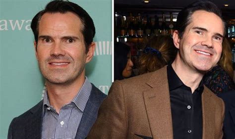 Jimmy Carr Addresses Real Reason He Underwent Hair Transplant And Got His Teeth Fixed