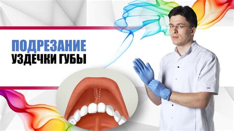 подрезание уздечки губы - YouTube