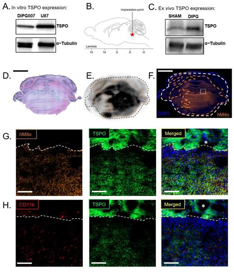 In Vitro And Ex Vivo Tspo Expression Of Hsjd Dipg 007 Cells A In