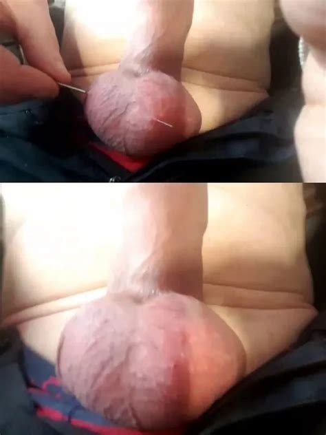 Cbt Bdsm Urethra Anal Estim Of Paul 46 Nude Pics XHamster