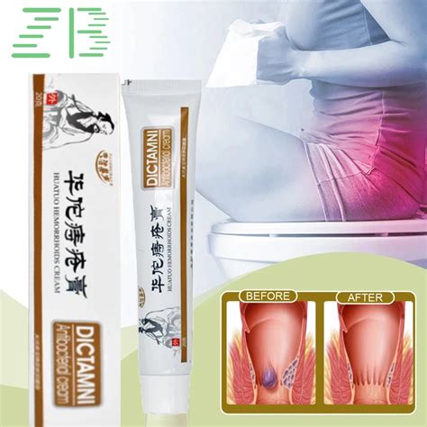 Hemorrhoids Ointment Internal External Anal Fissure Piles Pain Relief Cream Hemorrhoid Bleeding
