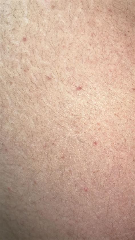 Why Does My Skin Look Like This R Dermatologyquestions