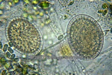 Algal Cells 1