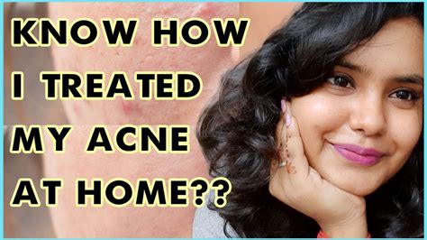 How To Remove Pimples Overnight {acne Treatment In A Week} Intrends