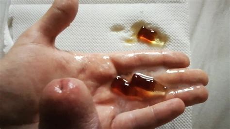 Urethral Sounding Gummy Cola In Cock Eat It Asmr Cum Again Gay Big Cock Big Cock Porn XHamster
