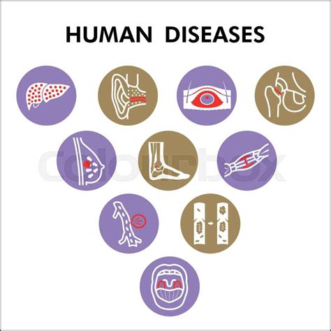 modern human diseases infographic design template  icons colourbox