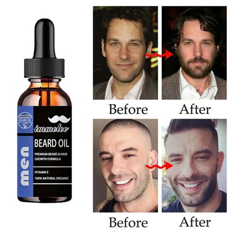 Концентрат для волос, 5 мл - купить с доставкой по выгодным ценам в ...