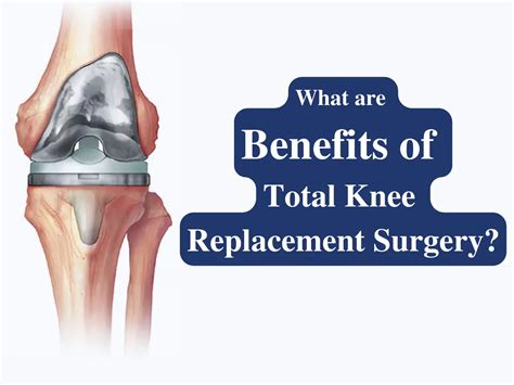 benefits  total knee replacement surgery