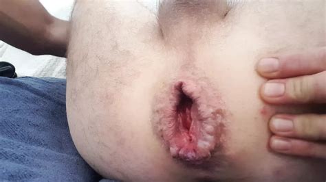 Cm Plug In My Asshole Free Gay Asshole Porn Xhamster Xhamster