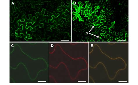 Subcellular Localization Of The Gfp Osabcg15 Fusion Protein In Download Scientific Diagram