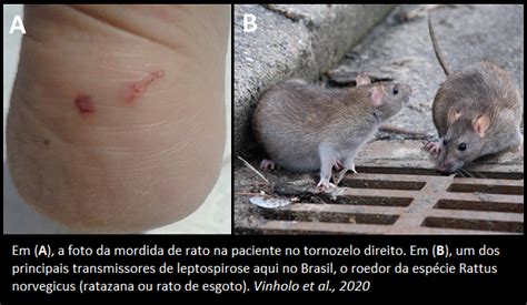 Mordida De Rato Pode Transmitir Leptospirose Saber Atualizado