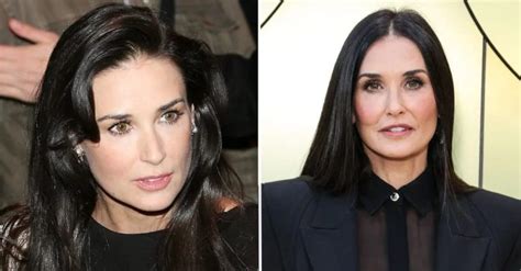 Demi Moore Plastic Surgery An In Depth Analysis