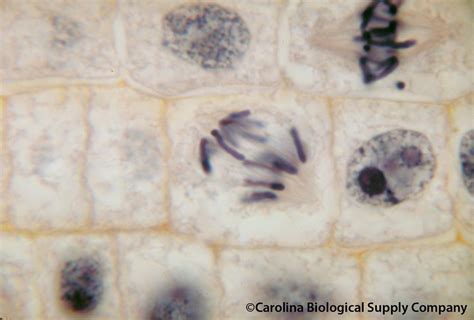 Onion root tip, mitosis | Mitosis, anaphase, Onion root tip.… | Flickr